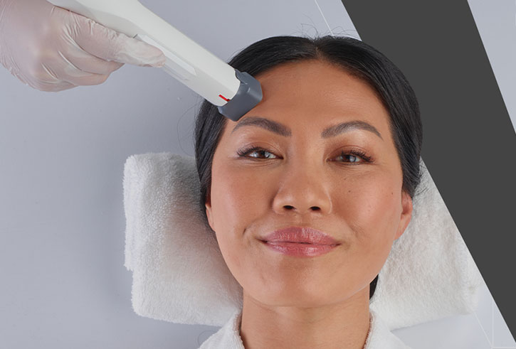 woman receiving xref treatment